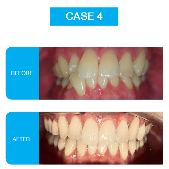 Website CS-02-17